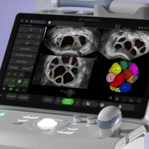 Voluson Swif - Global Medica